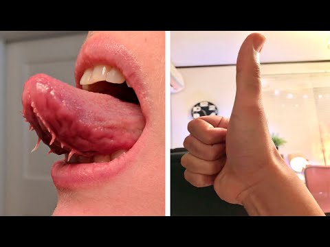 Видео: 50 людей, которых генетика сделала абсолютно уникальными