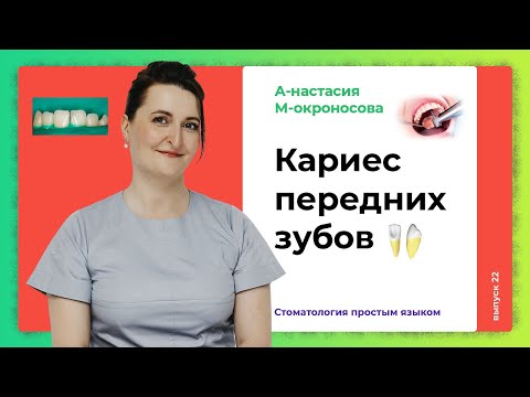 Видео: Как лечить кариес передних зубов? / Трудности лечения передних зубов