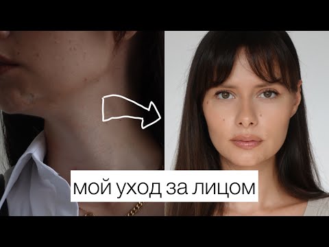 Видео: МОЙ УХОД ЗА КОЖЕЙ ЛИЦА КОТОРЫЙ ИЗМЕНИЛ ЕЕ КАРДИНАЛЬНО