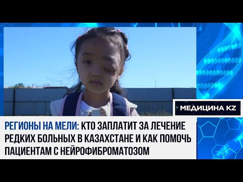 Видео: Проклятие генов: что такое нейрофиброматоз и как лечат болезнь в Казахстане | Медицина KZ