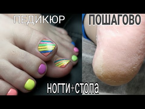 Видео: Классический педикюр пошагово использование лезвия, кератолитика для пяток, ремувера, щипцов и пилки