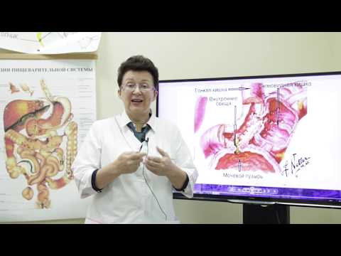 Видео: Появление крови в моче и кале. Что это такое и как это лечить.