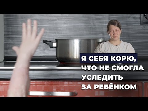 Видео: ОЖОГ КИПЯТКОМ | История Вити Шугаева