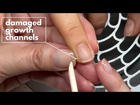 Видео: Твёрдая кожа на боковой поверхности ногтей | Повреждённые каналы роста [Посмотрите, как я работаю]