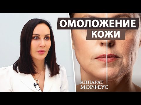 Видео: Почему именно RF лифтинг Morpheus? / Омоложение лица и Коррекция морщин