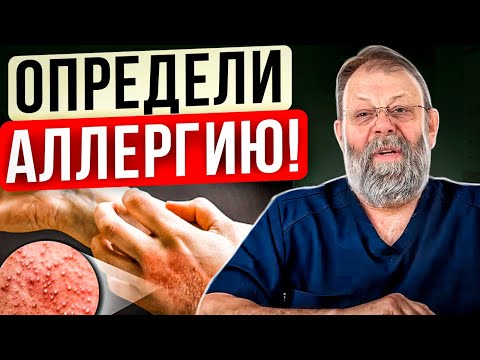 Видео: Аллергия и Печень. Причины и Лечение ЛЮБЫХ аллергических реакций!