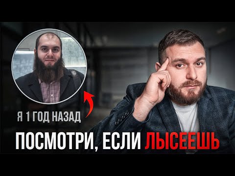 Видео: Что Делать, Если Начал ЛЫСЕТЬ? Спаси волосы...