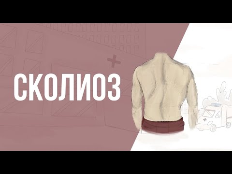 Видео: Что такое сколиоз и какой он бывает? Упражнения для людей со сколиозом