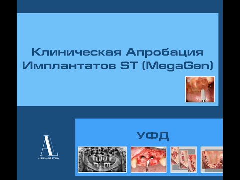 Видео: Апробация имплантатов ST УФД