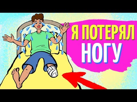 Видео: Я потерял левую ногу