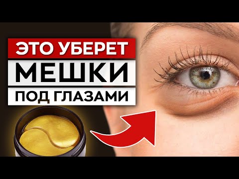 Видео: ВСЯ ПРАВДА про патчи! / Помогают ли ПАТЧИ ДЛЯ ЛИЦА избавиться от морщин?