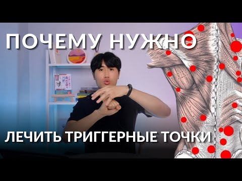 Видео: Как мышцы разрушают сустав | Зачем лечить триггерные точки?