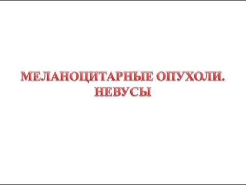 Видео: Меланоцитарные опухоли - невусы (родинки)