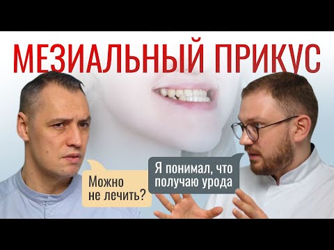 Видео: МЕЗИАЛЬНЫЙ ПРИКУС. Лечить или нет? А если лечить, то как?