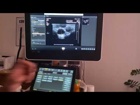 Видео: Чем меня расстраивает аппарат Philips Epiq7