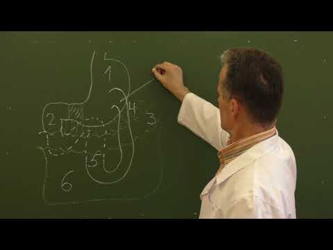 Видео: Схема гастроэнтеростомии