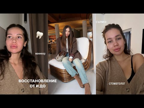 Видео: ВЛОГ: Удаляю ВСЕ Зубы Мудрости Под Седацией / Мой Опыт