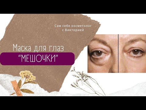 Видео: ✔️НАНОСИТЕ ПОД ГЛАЗА! БУДЕТЕ В ШОКЕ! НИ ОТЁКОВ, НИ МЕШКОВ!