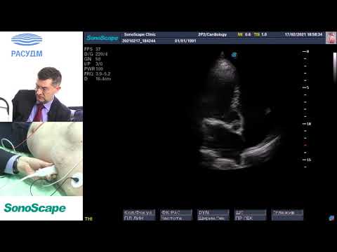 Видео: Мастер-класс на аппарате SonoScape S8Exp. Лектор: Алехин М.Н.