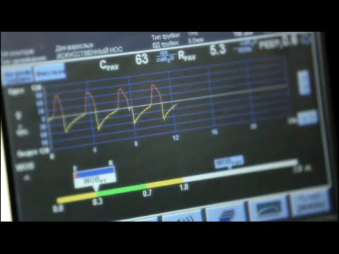 Видео: Искусственная вентиляция легких