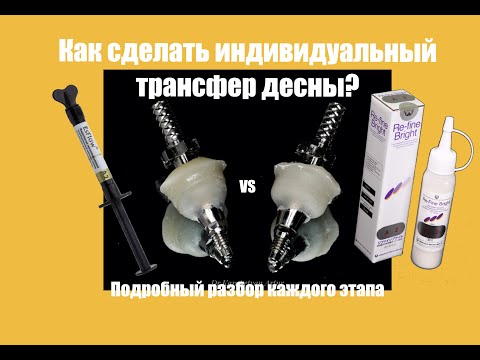 Видео: Как сделать индивидуальный трансфер десны имплантата?