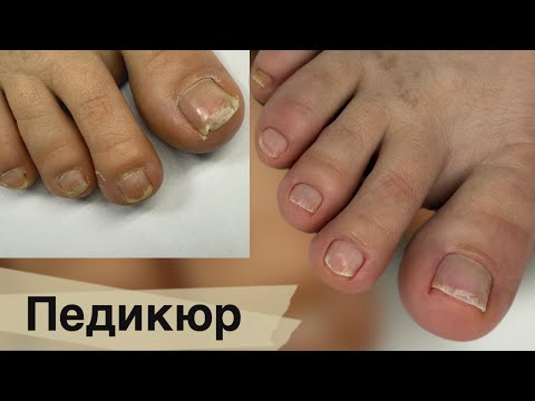 Видео: Эстетический педикюр #nails #pedicuremedicure #beauty #pedicure #pedicur #