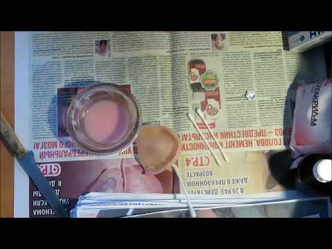 Видео: Перебазировка зубных протезов на дому ! 9 февраля 2023 год