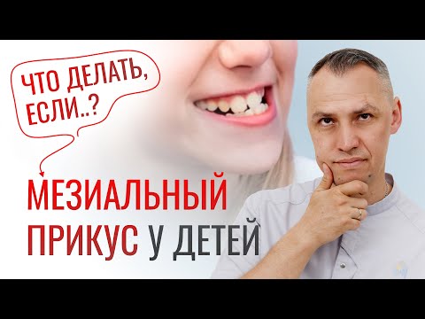 Видео: ЧЕМ ТАК СЛОЖЕН МЕЗИАЛЬНЫЙ ПРИКУС?