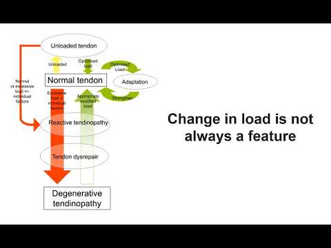 Видео: Индивидуализация лечения тендинопатии ахиллова сухожилия
