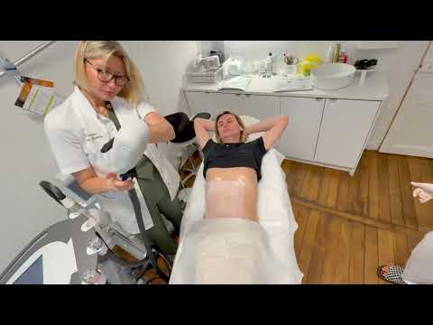 Видео: Замораживаю жиры - делаю Криолиполиз