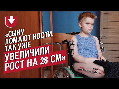 Видео: Моему сыну удлиняют ноги: Татьяна | Быть мамой