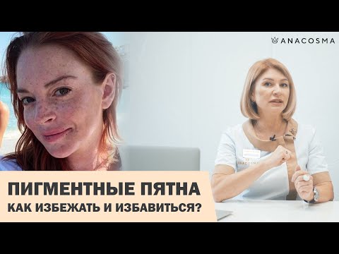 Видео: ПИГМЕНТНЫЕ ПЯТНА ⁉️😱 КАК ИЗБАВИТЬСЯ 🧐