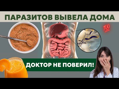 Видео: 10 ПРОСТЫХ СРЕДСТВ ! Врач удивился 🚫Паразиты уйдут НАВСЕГДА! 