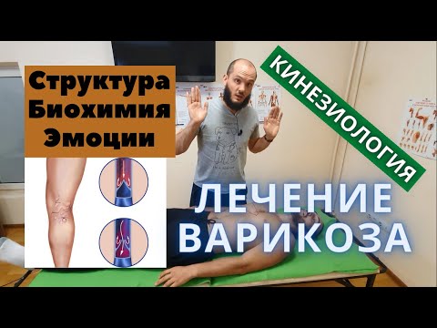 Видео: Лечение варикоза через эмоции. Техника от доктора Евгения. Прикладная кинезиология