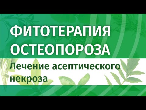 Видео: Фитотерапия остеопороза. Лечение асептического некроза.