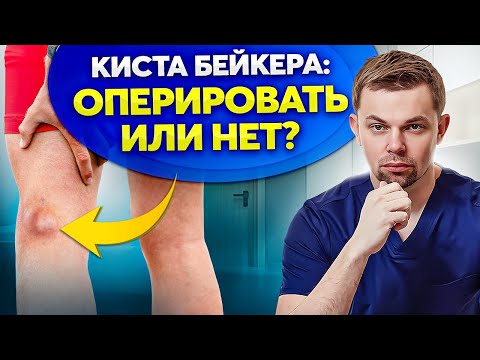 Видео: Киста Бейкера. Что делать, если нашли у себя?