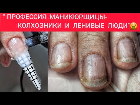 Видео: 🤮САМЫЙ УЖАСНЫЙ КЛИЕНТ ЗА ВСЮ МОЮ ПРАКТИКУ 😱🤬