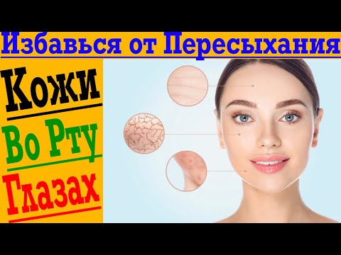 Видео: Как навсегда избавиться от СУХОСТИ кожи, в глазах или во рту!