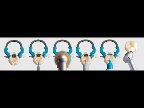 Видео: Комплексные решения по II классу Dentsply Sirona