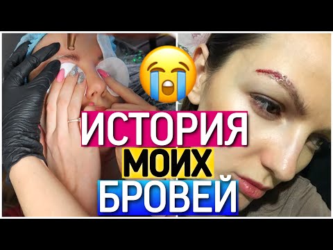 Видео: ИСТОРИЯ МОИХ БРОВЕЙ | ЛАЗЕРНОЕ УДАЛЕНИЕ ТАТУАЖА | НЕ ПОВТОРЯЙТЕ ЭТИХ ОШИБОК