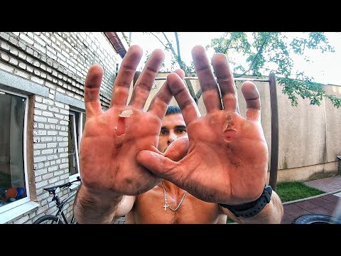 Видео: МОЗОЛИ НА РУКАХ И КАК С НИМИ БОРОТЬСЯ