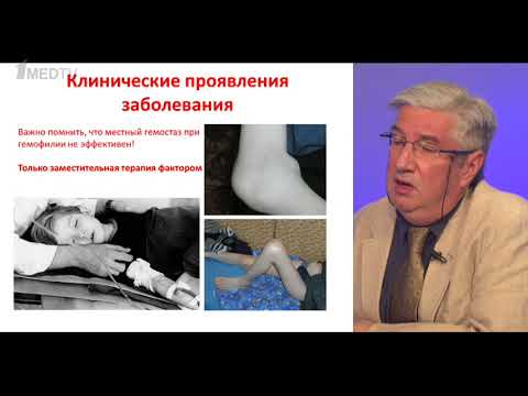 Видео: Тема лекции: "Диагностика и лечение гемофилии у детей"