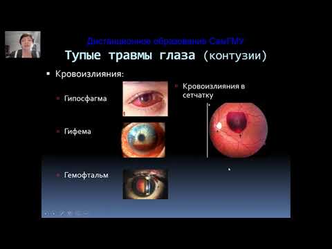 Видео: Повреждения глаз