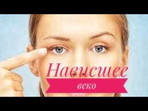 Видео: КАК ПОДНЯТЬ ВЕРХНЕЕ ВЕКО. Опущенное верхнее веко и отёк верхнего века.