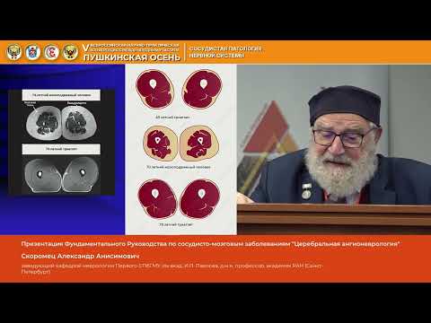 Видео: Скоромец Александр Анисимович Презентация Фундаментального Руководства по сосудисто мозговым забол