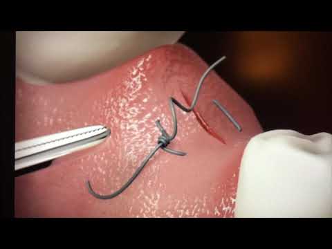 Видео: Инструментарий для хирурга имплантолога и ушивание