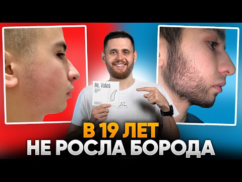 Видео: БОРОДА С НУЛЯ ВСЕГО ЗА 4 МЕСЯЦА / Результаты mr.Volos