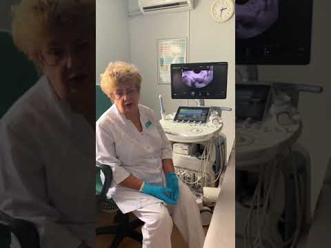 Видео: УЗИ после родов.