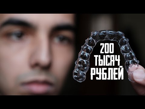 Видео: Подводные камни ЭЛАЙНЕРОВ