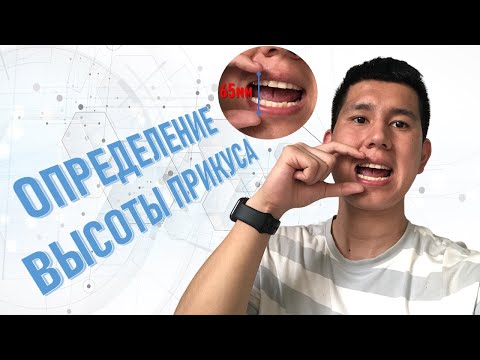 Видео: ОПРЕДЕЛЕНИЕ ВЫСОТЫ ПРИКУСА | РАСЧЁТ ПО ТРГ